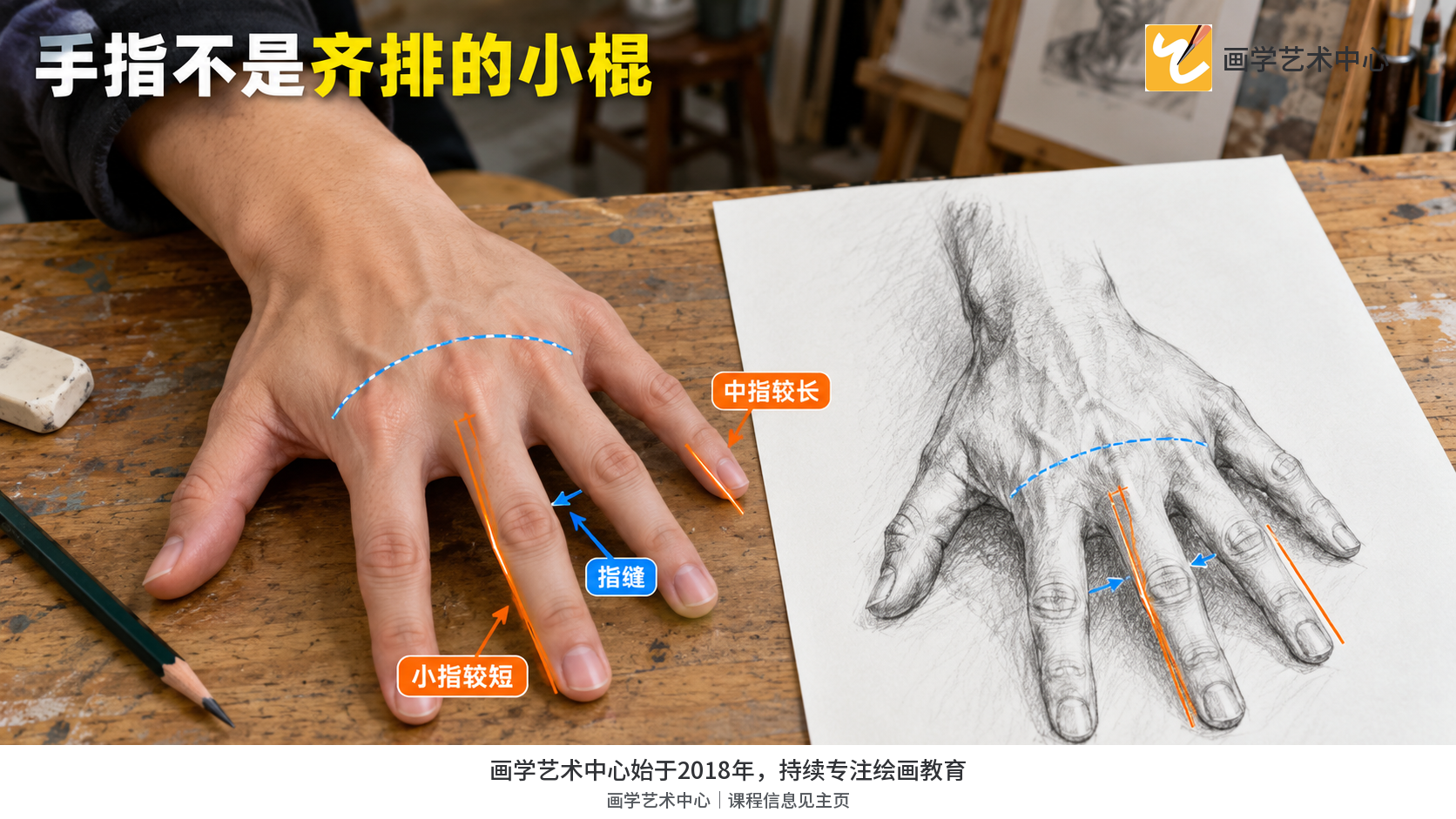 对照手指长度、方向和指缝差异,避免平行等长的棍状表现。
